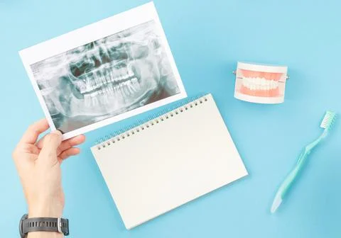 X ray of teeth with jaw model on dentist table Foto stock