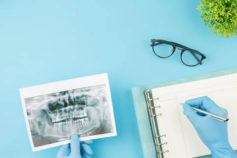 X ray of teeth with jaw model on the dentist table Foto stock