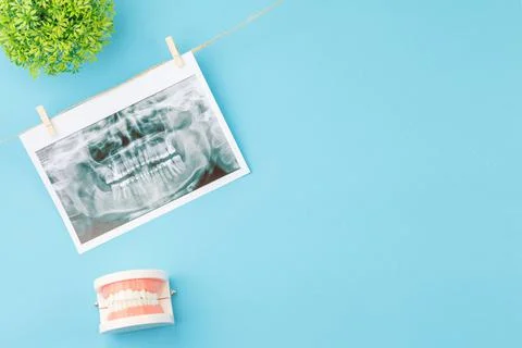 X ray of teeth with jaw model on the dentist table Stock Photos
