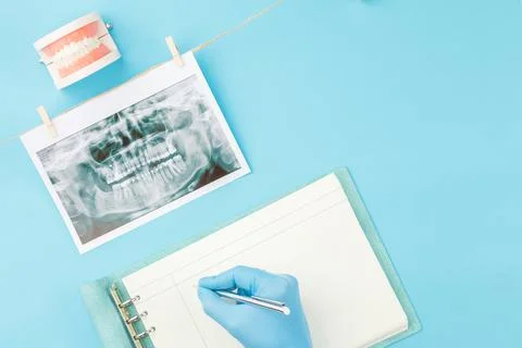 X ray of teeth with jaw model on the dentist table Stock Photos