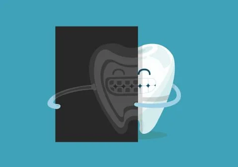 X-ray tooth Stock Illustration