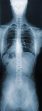 X-ray of the torso Stock-Fotos