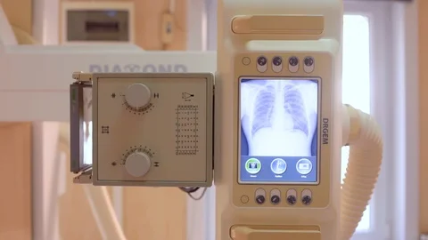 X-Ray Unit is working for Lungs Film Stock Footage 127283209
