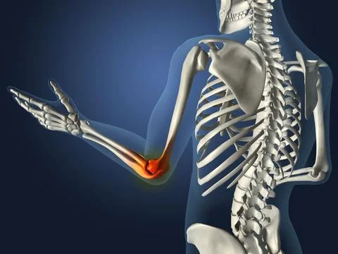 X-ray view of elbow joint red with inflammation in a see-through arm with hand Stock Illustration
