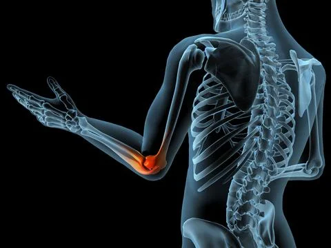 X-ray view of elbow joint with red inflammation in a see-through arm with hand Stock Illustration