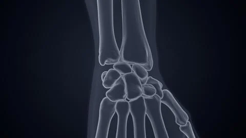 X-ray of Wrist joint 3D illustration Stock Illustration