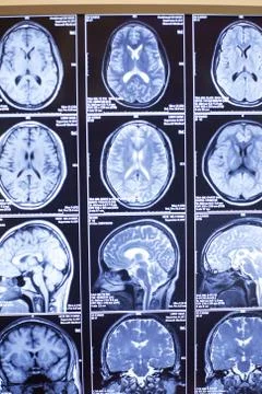 X-rays, the body structure Stock Photos