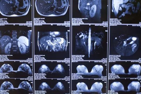 X-rays, the body structure Stock-Fotos