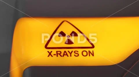 X-rays danger alert light on Stock Photos