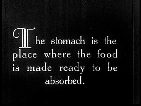 X-rays demonstrating the stomach's function in the digestive tract in theƒ Video stock 75289922