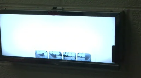 X-Rays Video stock 359436