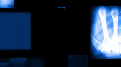 X-Rays Stock Footage 24078832