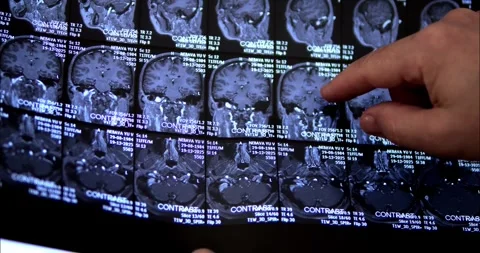 X-rays of the head, brain. X-rays of the back and spine. Doctor's examinati.. Stock Footage 332437525