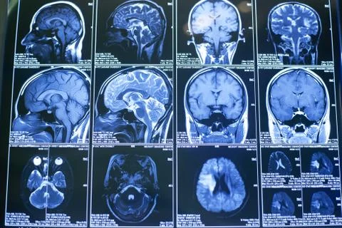 X-rays, the human brain Stock-Fotos