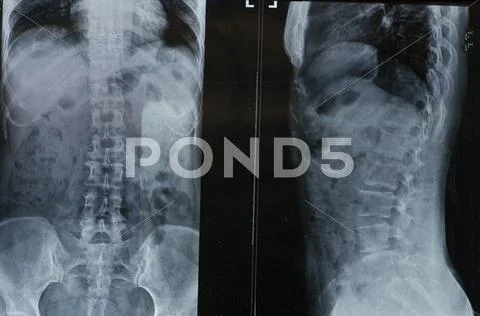 X-rays Stock Photos
