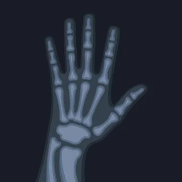 X Rays Style Human Hand. Vector Иллюстрация
