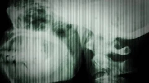 X Rays Texture Video stock 65003921