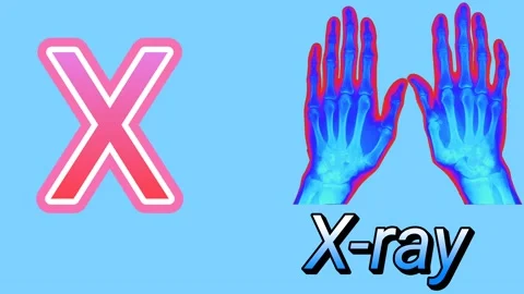 X for X - ray - Alphabet learning for kids -  ABC learning  for kids HD(4k) Stock Footage 221029758