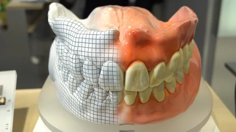 XL Dental Prothesis Stock Footage 92624275