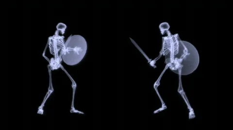 Xray of 2 human skeleton fighting in a sword combat Stock Footage 296584