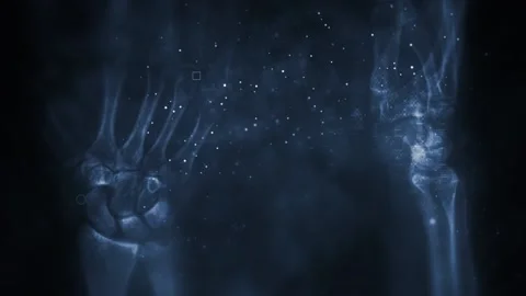 Xray Bones Forensic Cinematic Stock Footage 134546871