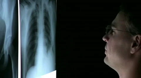Xray CloseUp Stock Footage 586633