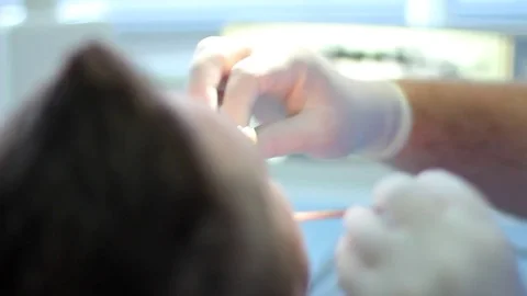 Xray details Video stock 84722489