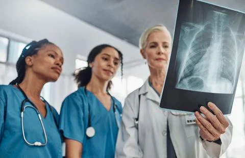 Xray, doctor and nurses, team and medicine with analysis of lung scan and Stock Photos