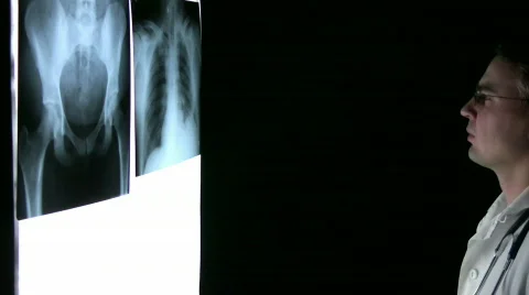 Xray Doctor Stock Footage 586679