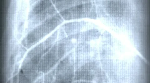 XRay Fast Motion Stock Footage 11018736