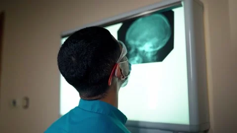 XRay Video stock 151786193