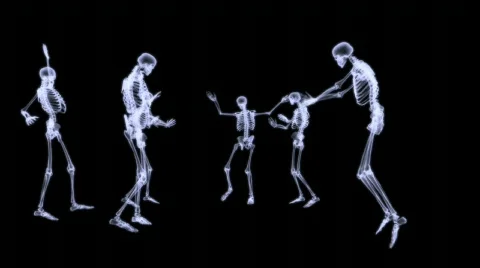 Xray - Group of human skeleton dancing Stock Footage