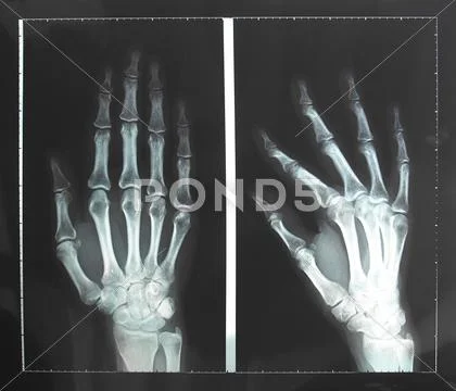 Xray Stock Photos
