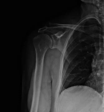 Xray Stock Photos