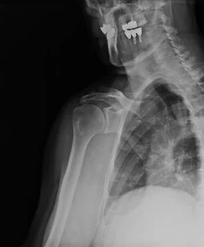 Xray Foto stock