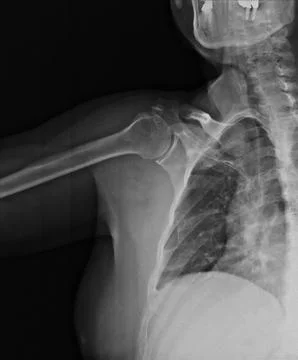 Xray Foto stock