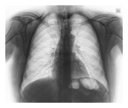 Xray 스톡 사진