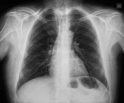 Xray Stock Photos