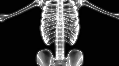Xray Skeleton Stock Footage 61465650