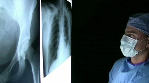 Xray Surgeon Stock-Footage 586763