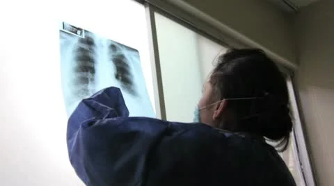 Xrays Stock Footage 10606494