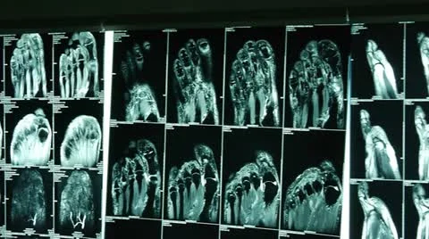 Xrays Video stock 21258699