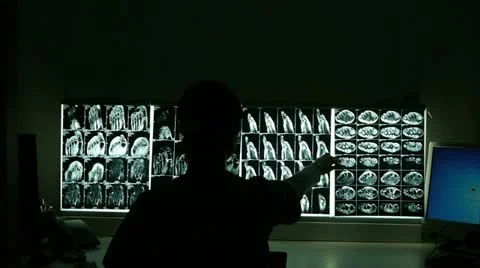 Xrays Video stock 21258835