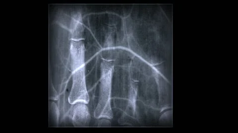 XraySkeleton Stock Footage 50563599