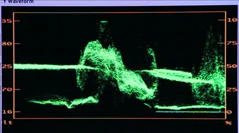 Y-Waveform 動画素材 21876387