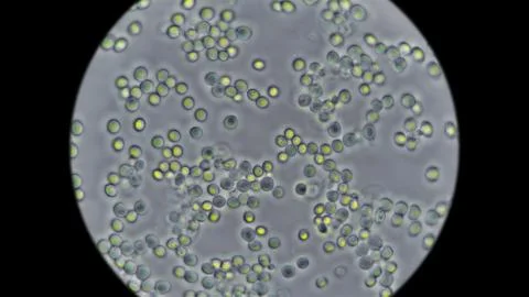 Yeast under the microscope, used for baking bread. Stock Photos
