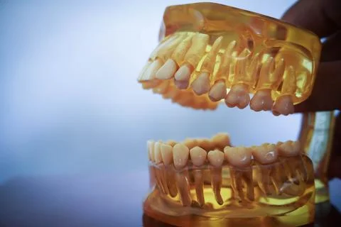 Yellow artificial model of the jaw on the table. Dental Prosthesis. tooth p.. Stock Photos
