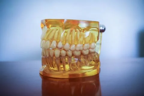 Yellow artificial model of the jaw on the table. Dental Prosthesis. tooth p.. Stock Photos