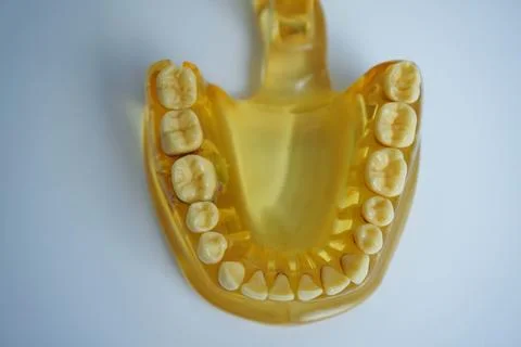 Yellow jaw model on white background. Dentures or false teeth Stock Photos