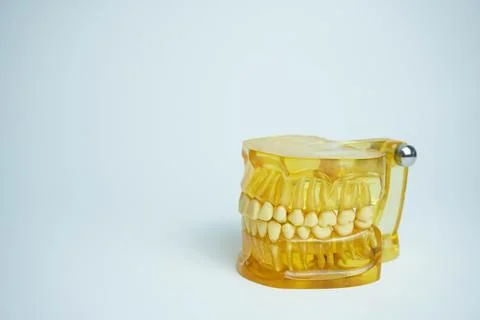 Yellow jaw model on white background. Dentures or false teeth Stock Photos
